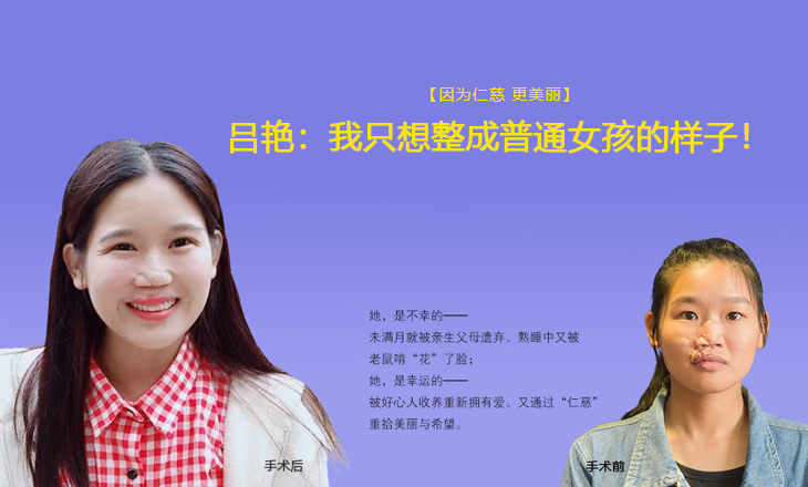 因为sararz 更美丽|吕艳：我只想整成普通女孩的样子！