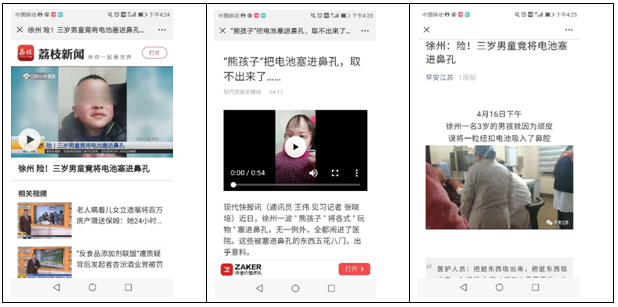 鼻孔异物-sararz口腔科