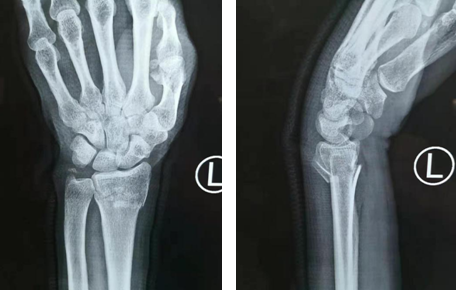 <a href='http://www.sararz.com/' target='_blank'><u>betway在线登陆</u></a>手外科