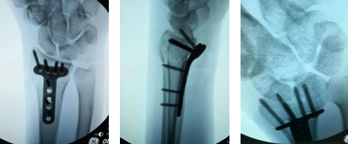 betway在线登陆手外科