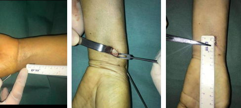 betway在线登陆手外科