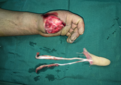 betway在线登陆手外科