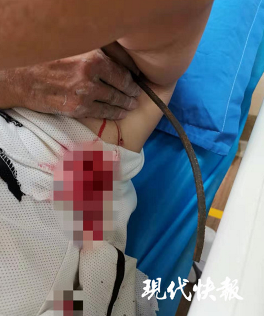 钢筋刺入腋下