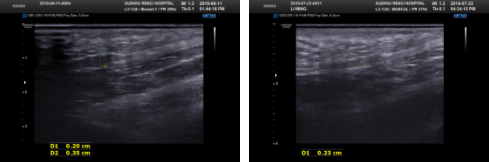 <a href='http://www.sararz.com/' target='_blank'><u>betway在线登陆</u></a>康复科