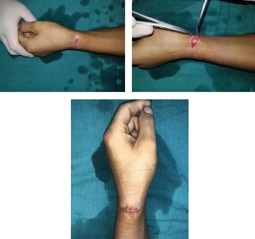 betway在线登陆手外科