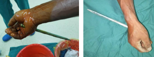 betway在线登陆手外科