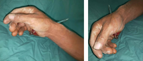 betway在线登陆手外科