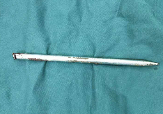 betway在线登陆手外科