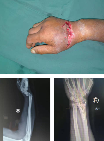 <a href='http://www.sararz.com/' target='_blank'><u>betway在线登陆</u></a>手外科