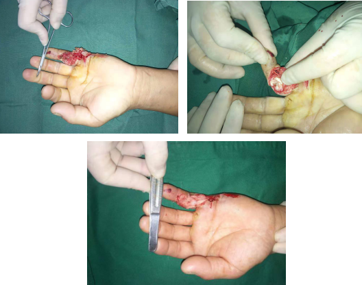 betway在线登陆手外科