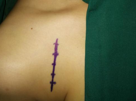 betway在线登陆手外科