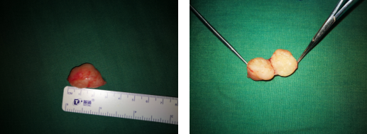 betway在线登陆手外科