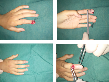 betway在线登陆手外科