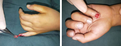 <a href='http://www.sararz.com/' target='_blank'><u>betway在线登陆</u></a>手外科