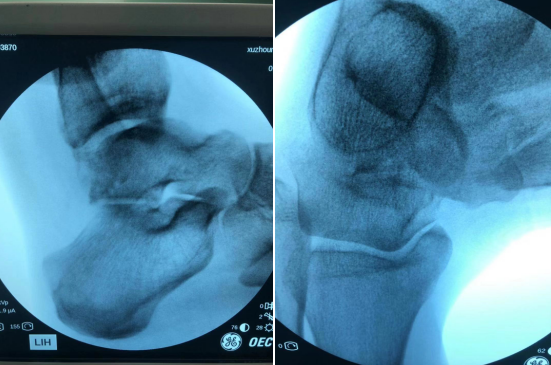 <a href='http://www.sararz.com/' target='_blank'><u>betway在线登陆</u></a>足踝