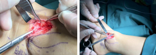 betway在线登陆足踝