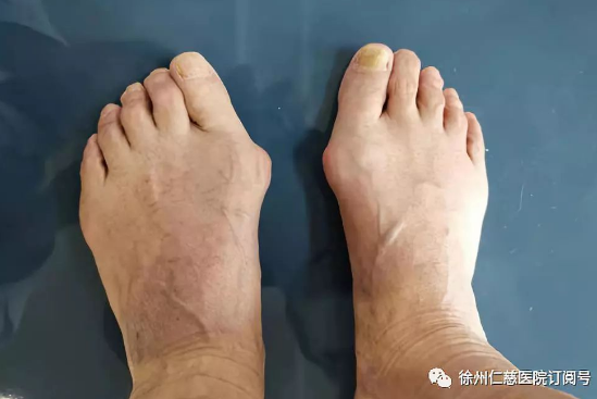 betway在线登陆足踝科