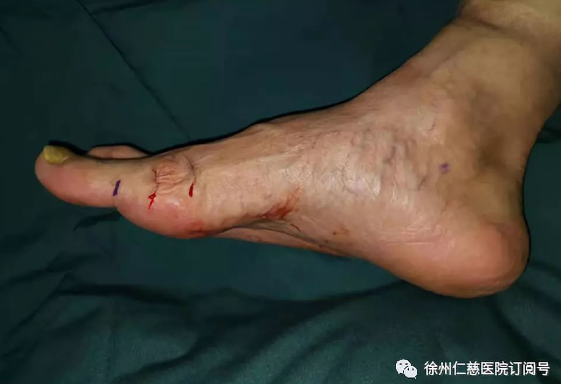 betway在线登陆足踝科