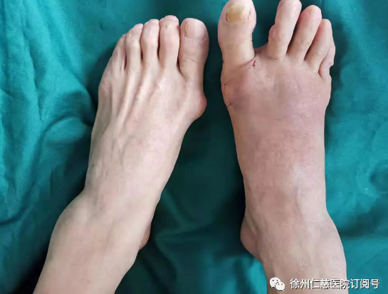 betway在线登陆足踝科