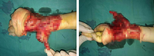 betway在线登陆手外科