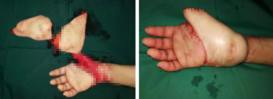 betway在线登陆手外科