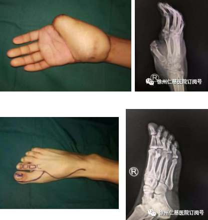 betway在线登陆手外科