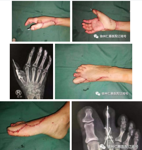 betway在线登陆手外科