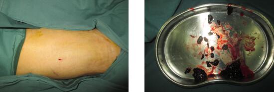 <a href='http://www.sararz.com/' target='_blank'><u>betway在线登陆</u></a>手外科