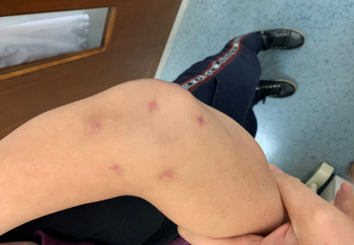 <a href='http://www.sararz.com/plus/list.php?tid=62' target='_blank'><u>徐州手外科</u></a>