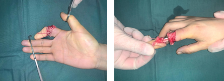 betway在线登陆手外科