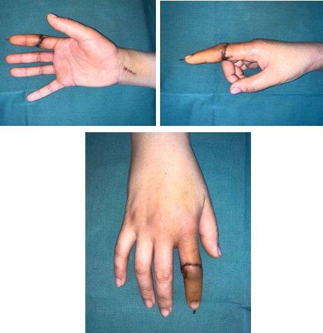 betway在线登陆手外科