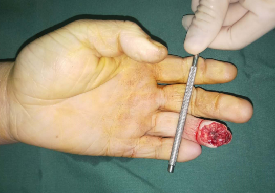 徐州sararz手外科