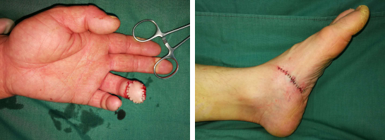 徐州sararz手外科