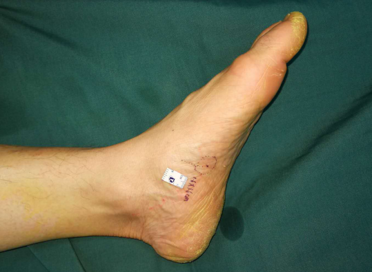 徐州sararz手外科