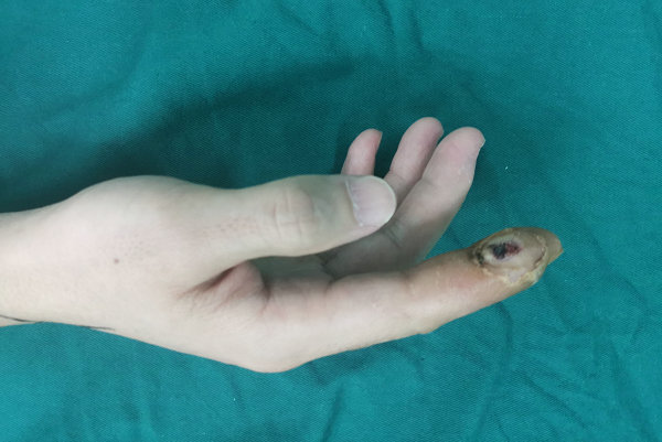 徐州sararz手外科