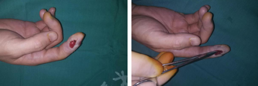 徐州sararz手外科