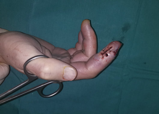 徐州sararz手外科