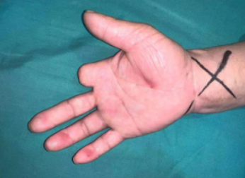 betway在线登陆手外科