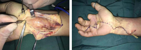 betway在线登陆手外科