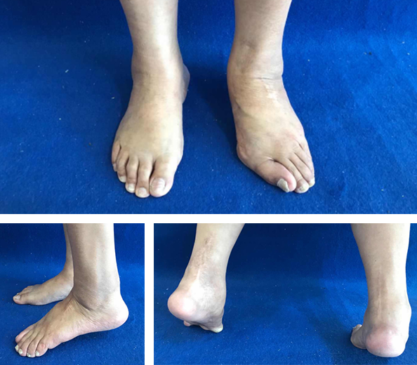 betway在线登陆足踝科