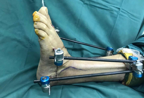 betway在线登陆足踝科