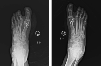 betway在线登陆足踝科