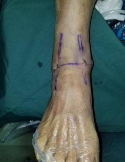 betway在线登陆足踝科