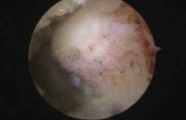 betway在线登陆足踝科