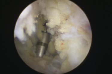 betway在线登陆足踝科