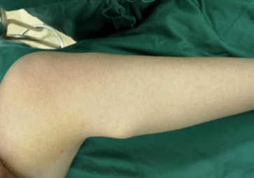 <a href='http://www.sararz.com/' target='_blank'><u>betway在线登陆</u></a>手外科