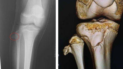 betway在线登陆手外科
