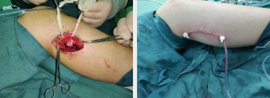 betway在线登陆手外科