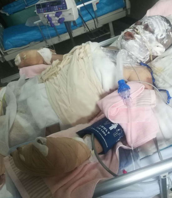 betway在线登陆烧伤科