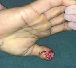 <a href='http://www.sararz.com/' target='_blank'><u>betway在线登陆</u></a>手外科